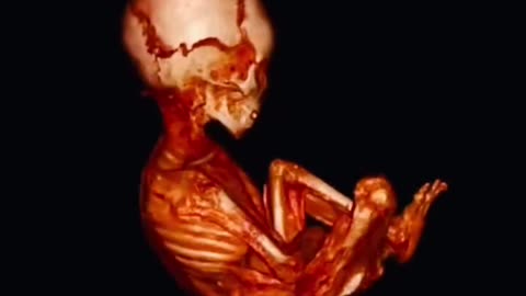 Newly Revealed Nazca Mummy 'Santiago': Alien Proof or Hoax?