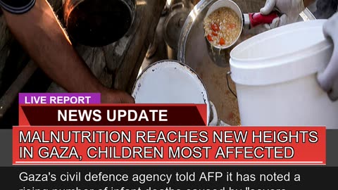 Malnutrition Reaches New Heights in Gaza Children