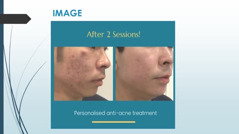 Best Skin Lifting in Norwood