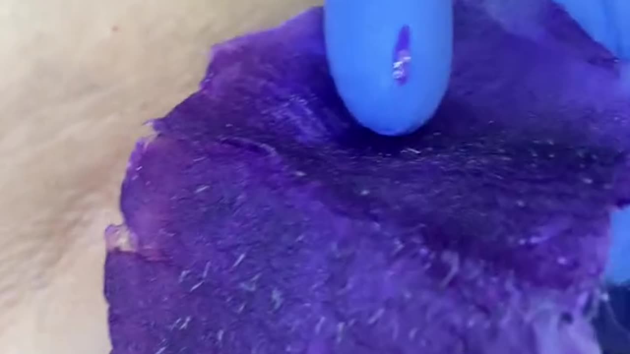 Underarm Waxing with Sexy Smooth Purple Seduction & Tickled Pink Hard Wax | @skin.boss_