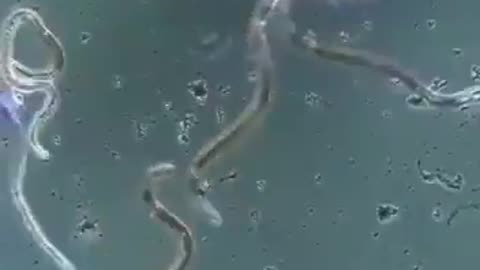 Ivermectin kills Parasites.