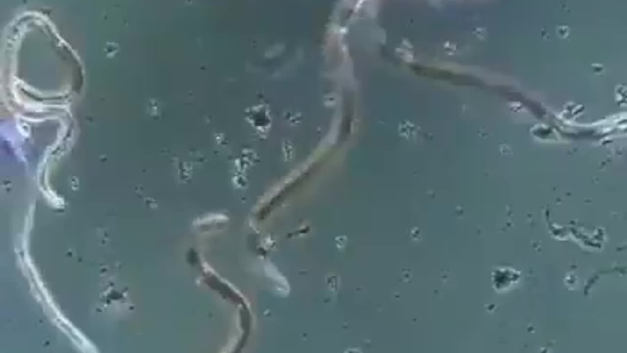 Ivermectin kills Parasites.