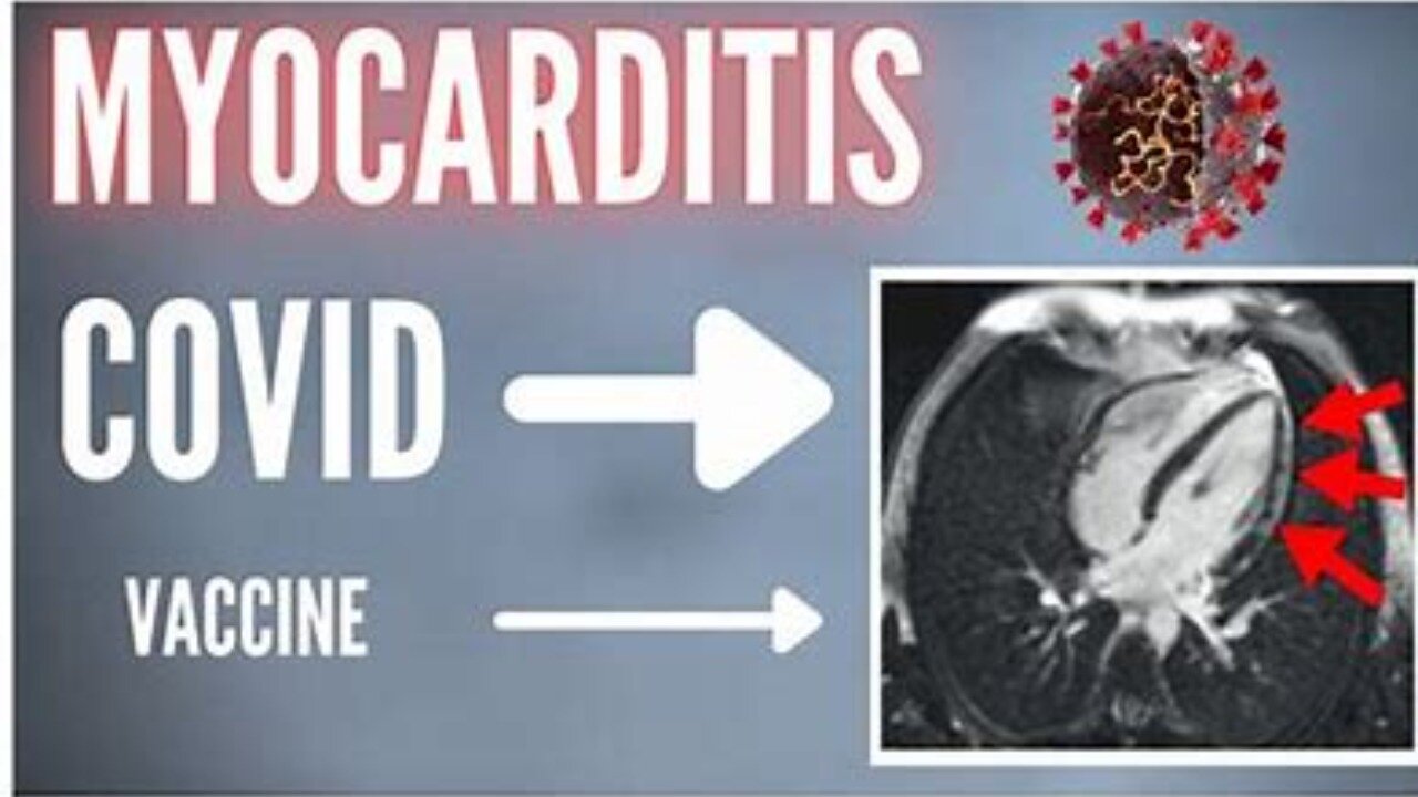 Covid Vaccine Reports Data Reports Myocarditis