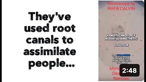 "People Assimilated Through Use of 'Root Canals'"