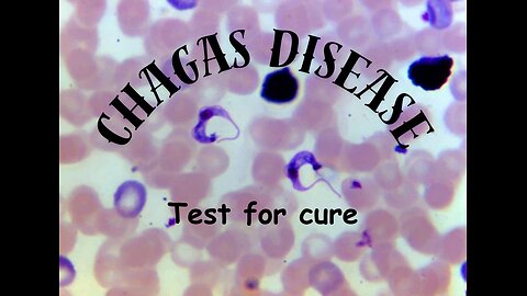 Chagas disease: Test for cure