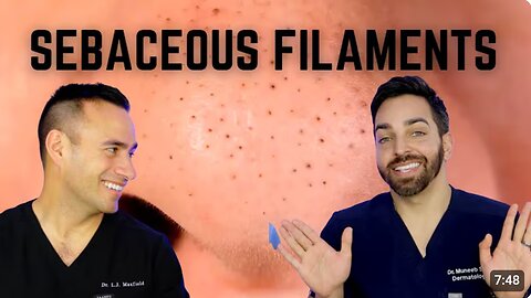 Black Dots on the Nose? Here's How To Treat Sebaceous Filaments