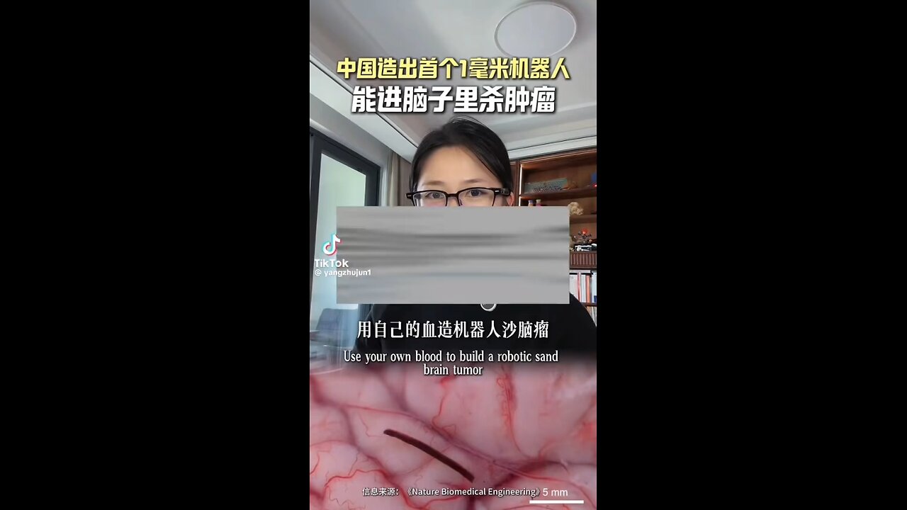 China AI assisted microscopic surgery is way ahead of the US & EU