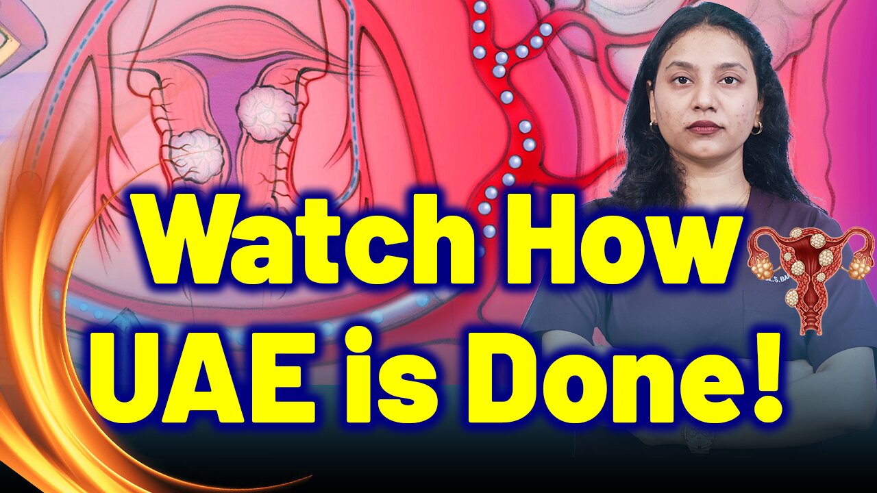 UAE Procedure Explained – Watch the Process! | Treatment & Cure| Homeopathy, Medicine & Surgery