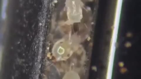 Phone under microscope