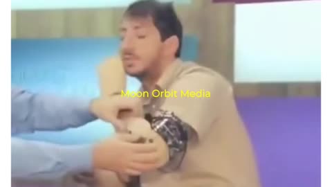 Artificial Arm Malfunction During Interview! 😳😂