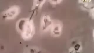 Actual Footage of Fluoride Killing Cells