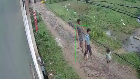 7 year old Shrishti was attacked by stray dogs in Mathura, Streets belongs to Dogs, not our Kids.