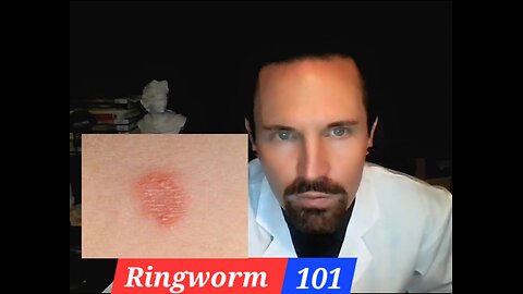 Ringworm 101 The Basics