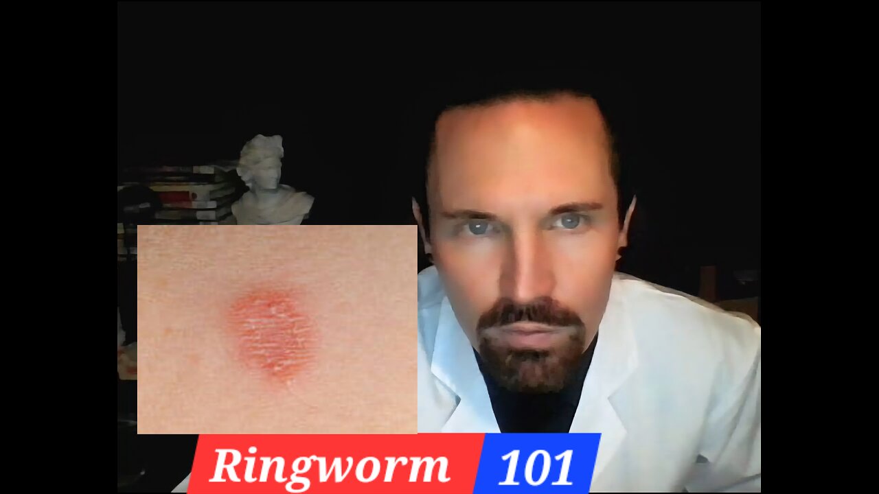 Ringworm 101 The Basics