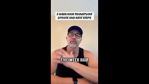 5 WEEKS HAIR TRANSPLANT UPDATE