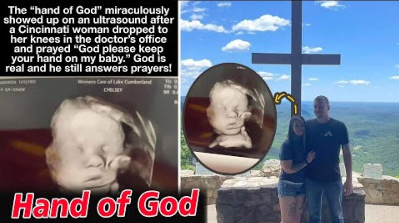 Hand of God mysteriously appears in an ultrasound