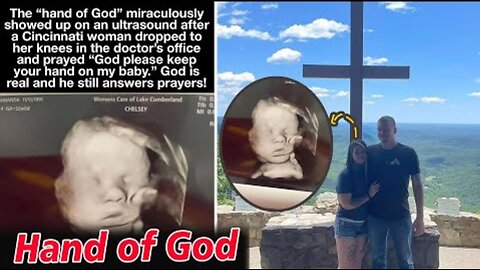 'Hand of God' mysteriously appears in an ultrasound
