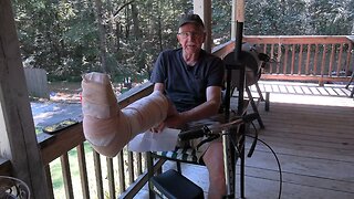 I Broke my Leg!