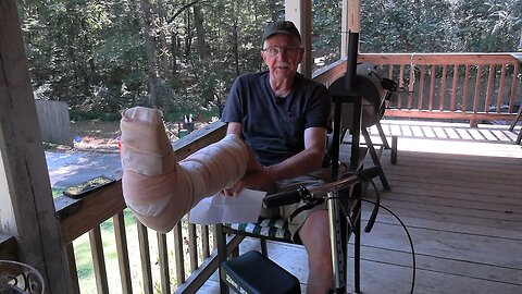 I Broke my Leg!