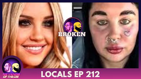 Locals EP 212: Broken