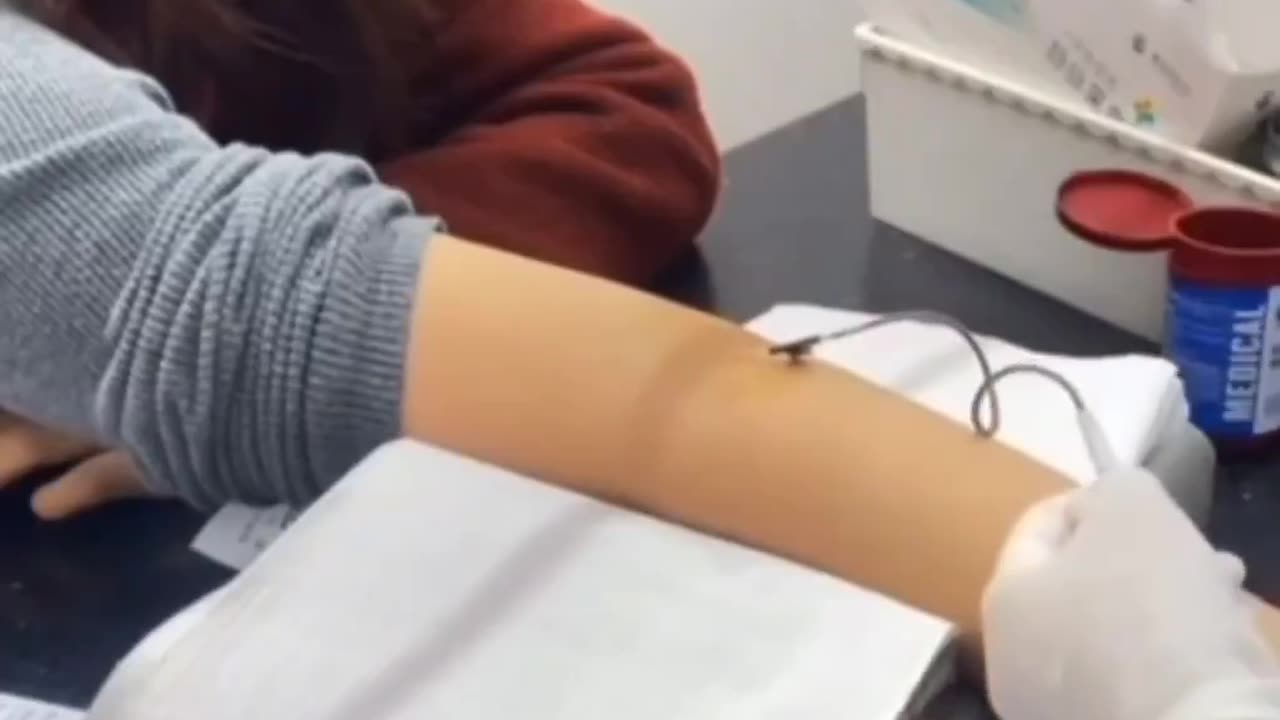 Chinese nurse uses this technique called "flying needle" to draw blood.