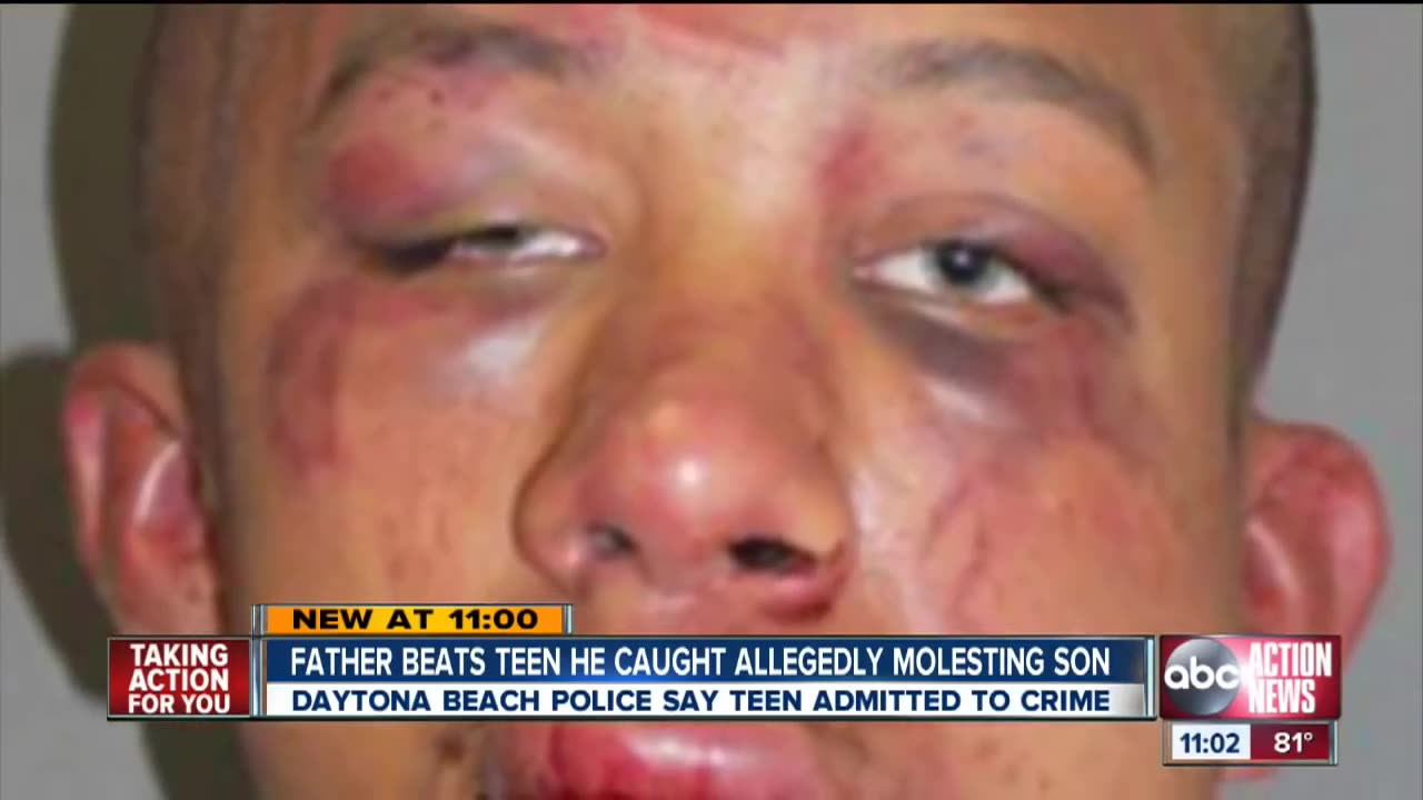 Father beats black teen he caught allegedly molesting son