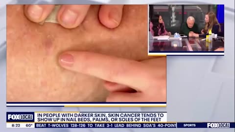 Fox Anchor Diagnosed with Skin Cancer During Live TV Segment: 'What?!'