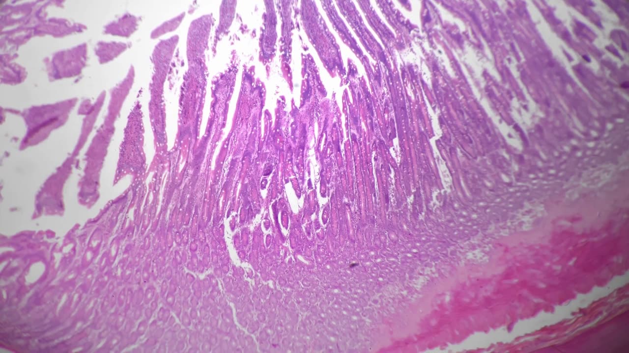 Episode 21: Buckthorn - A Gentle Laxative if Taken Correctly