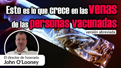 Esto Crece En Las Venas De Las Personas Vacunadas klatv