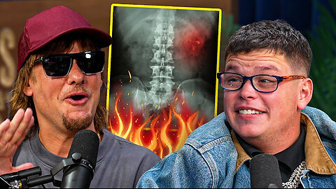 Sketch's Health is Still Very Questionable...