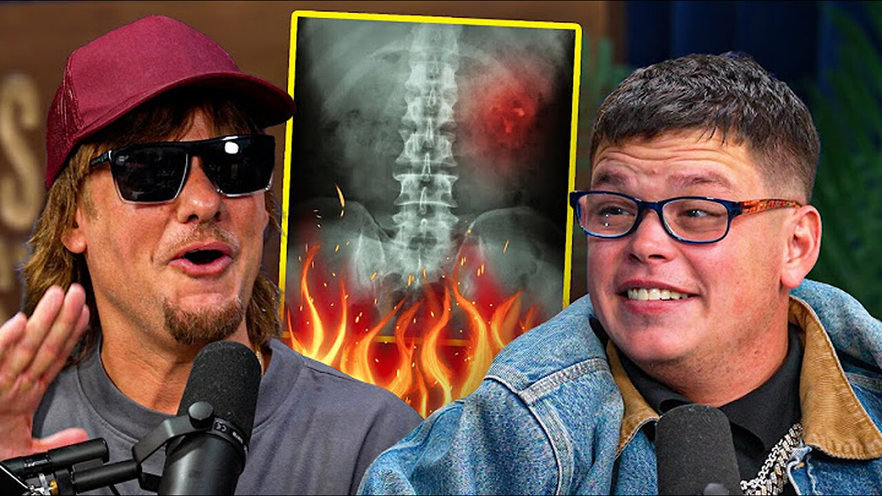 Sketch's Health is Still Very Questionable...