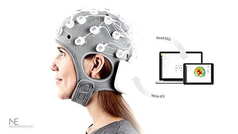ITU-JFET AI FOR GOOD: How AI neurotwins improve neuromodulation treatments for mental health