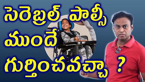 సెరెబ్రల్ పాల్సీ లక్షణాలు | Cerebral Palsy Early Signs In Child | Brain Disorder Homeopathy Medicine