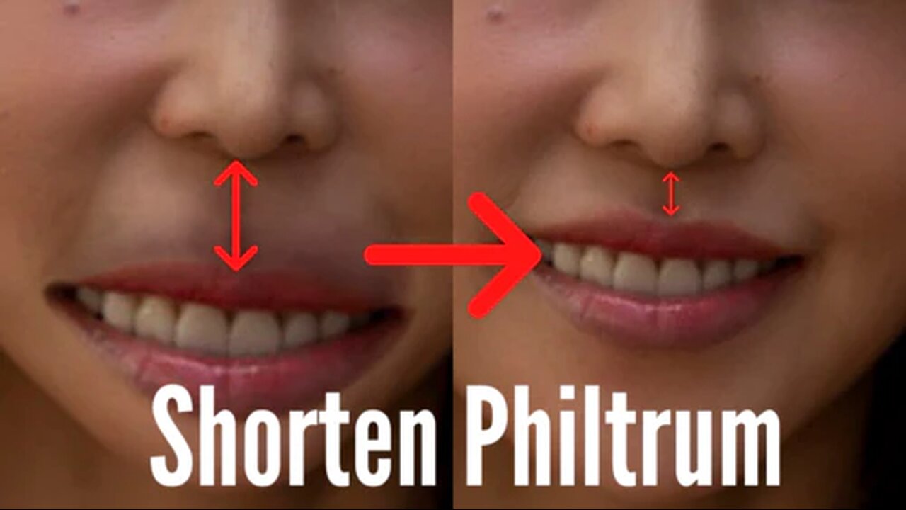 Shorten Philtrum with Face Yoga: Upper Lip & Nose Training