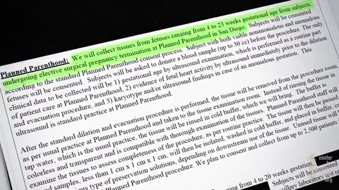 Planned Parenthood Sells Fetuses