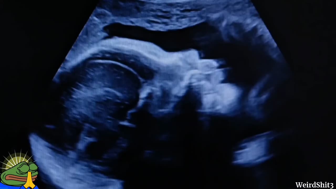 Hand Of God Shows Up On Woman's Ultrasound?