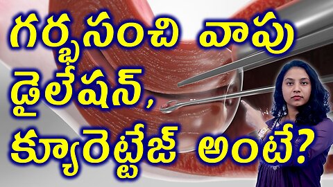 గర్భసంచి వాపు డైలేషన్ & క్యూరెట్టేజ్ అంటే? Bulky Uterus Dilation and curettage (D&C) Treatment Cure