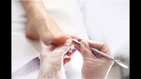 Cleaning is very needed! Home Service Pedicure Series #ingrowntoenail #toenails #pedicure (6)