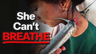 the Most Disturbing Freak Accidents Iceberg