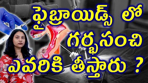 ఫైబ్రాయిడ్స్ లో గర్భసంచి ఎవరికి తీస్తారు?Conditions for Hysterectomy,Uterus Removal Fibroids Surgery