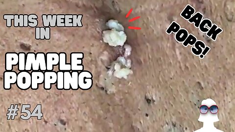 This Week In PIMPLE POPPING #54