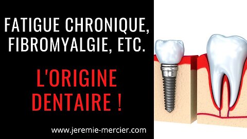 Fatigue Chronique, Fibromyalgie, etc. : l'origine dentaire !