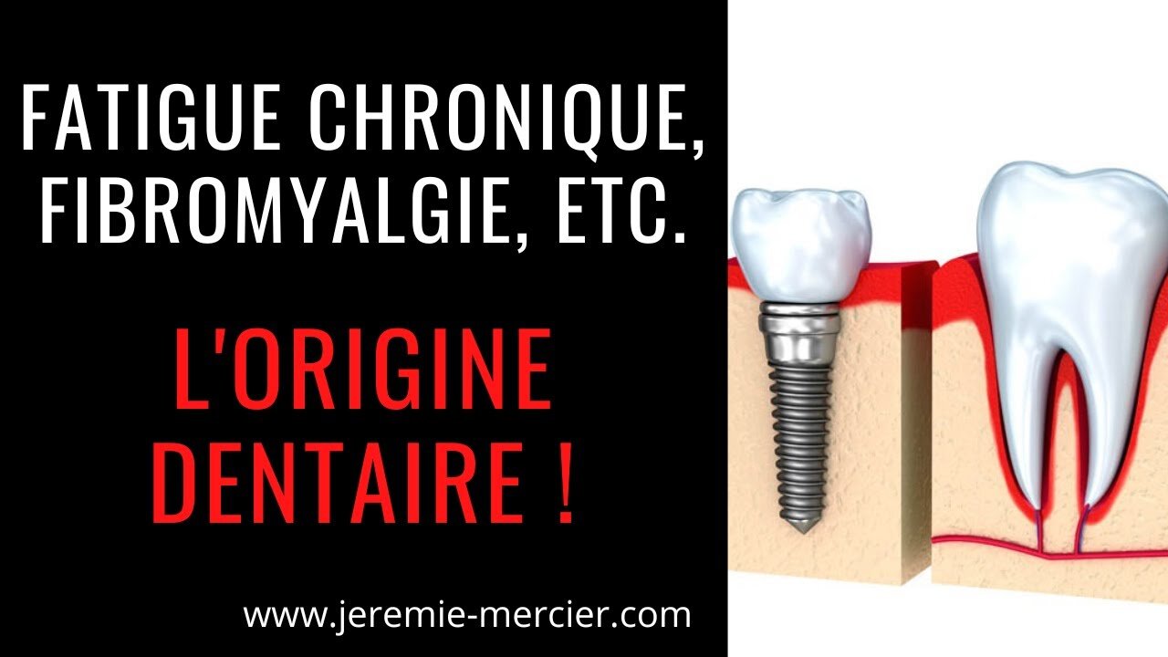 Fatigue Chronique, Fibromyalgie, etc. : l'origine dentaire !