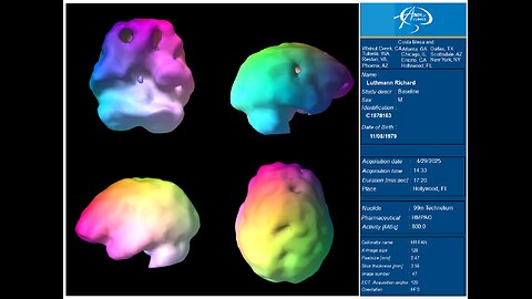 BRAIN SCANS BROKEN SYSTEMS