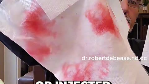 How to Identify Watermelons That Have Been Chemically Injected With Toxins