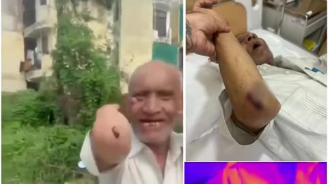 Gurgaon: Son, In-Laws Brutally Assault 75-Year-Old Father Over Property