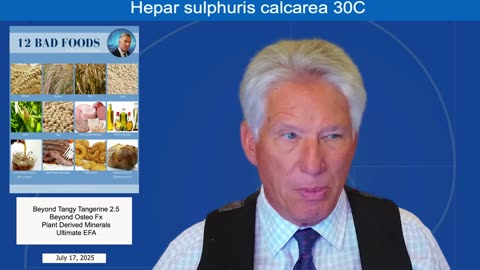 Q&A July 17, 2025