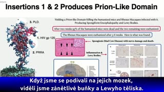 Dr Richard Fleming PhD, MD, JD HIV in the spike protein.