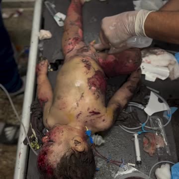 I will not comment, I will not write, and I will not forgive anyone (Graphic warning)