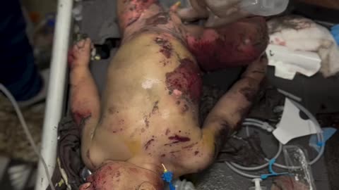 I will not comment, I will not write, and I will not forgive anyone (Graphic warning)